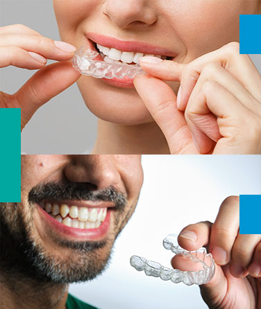 Ortodoncia Invisible en Málaga, alineadores invisible  invisalign